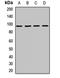 Interleukin 17 Receptor A antibody, orb411656, Biorbyt, Western Blot image 