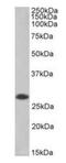 Acidic Nuclear Phosphoprotein 32 Family Member B antibody, orb389356, Biorbyt, Western Blot image 