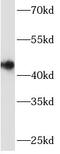 Arylsulfatase B antibody, FNab00611, FineTest, Western Blot image 