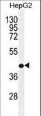 Retinol dehydrogenase 13 antibody, LS-C162523, Lifespan Biosciences, Western Blot image 