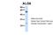 ALG6 Alpha-1,3-Glucosyltransferase antibody, 26-177, ProSci, Western Blot image 