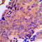 ADP/ATP translocase 3 antibody, LS-C353890, Lifespan Biosciences, Immunohistochemistry paraffin image 