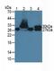 Troponin I1, Slow Skeletal Type antibody, MBS2001356, MyBioSource, Western Blot image 