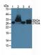 Troponin I1, Slow Skeletal Type antibody, MBS2001356, MyBioSource, Western Blot image 