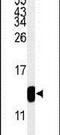 TMIE antibody, PA5-26765, Invitrogen Antibodies, Western Blot image 