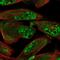 Zinc Finger DHHC-Type Containing 15 antibody, NBP1-82014, Novus Biologicals, Immunofluorescence image 