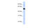 THUMP Domain Containing 2 antibody, 26-363, ProSci, Western Blot image 