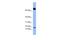 Platelet factor 4 variant antibody, A08914, Boster Biological Technology, Western Blot image 