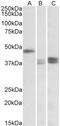 Thioredoxin Domain Containing 5 antibody, EB10878, Everest Biotech, Western Blot image 