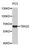 T-Box 22 antibody, STJ26811, St John