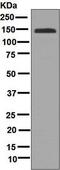 Glycoprotein Ib Platelet Subunit Alpha antibody, ab134087, Abcam, Western Blot image 