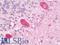 Coronin 1B antibody, LS-B11200, Lifespan Biosciences, Immunohistochemistry paraffin image 