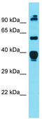 Diacylglycerol O-Acyltransferase 1 antibody, TA343309, Origene, Western Blot image 