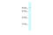 Glutamate Receptor Interacting Protein 1 antibody, 27-615, ProSci, Western Blot image 