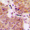 Mitogen-Activated Protein Kinase Kinase Kinase 1 antibody, LS-C356171, Lifespan Biosciences, Immunohistochemistry paraffin image 