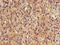 Tubulin alpha-3C/D chain antibody, LS-C395223, Lifespan Biosciences, Immunohistochemistry paraffin image 