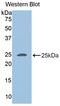 Perilipin 2 antibody, LS-C716755, Lifespan Biosciences, Western Blot image 