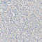 Podoplanin antibody, HPA007534, Atlas Antibodies, Immunohistochemistry frozen image 