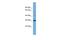 Chymotrypsin Like Elastase 2A antibody, A10823, Boster Biological Technology, Western Blot image 