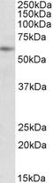 Protein Inhibitor Of Activated STAT 2 antibody, EB09879, Everest Biotech, Western Blot image 