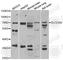 Solute Carrier Family 23 Member 2 antibody, A6740, ABclonal Technology, Western Blot image 