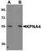 Karyopherin Subunit Alpha 4 antibody, orb94589, Biorbyt, Western Blot image 