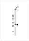 Envoplakin Like antibody, 56-339, ProSci, Western Blot image 