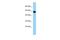 Synaptotagmin 14 antibody, A11213, Boster Biological Technology, Western Blot image 