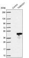 Transmembrane Protein 231 antibody, NBP1-91905, Novus Biologicals, Western Blot image 