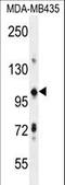 Tripartite Motif Containing 33 antibody, LS-C160188, Lifespan Biosciences, Western Blot image 