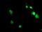 ACD Shelterin Complex Subunit And Telomerase Recruitment Factor antibody, MA5-25904, Invitrogen Antibodies, Immunocytochemistry image 