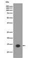 Histone Cluster 1 H2A Family Member E antibody, M16777-3, Boster Biological Technology, Western Blot image 