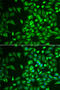 Lecithin Retinol Acyltransferase antibody, 22-377, ProSci, Immunofluorescence image 