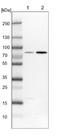 Histidine Ammonia-Lyase antibody, NBP1-89694, Novus Biologicals, Western Blot image 