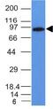 MALT1 Paracaspase antibody, GTX34812, GeneTex, Western Blot image 