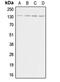 Adenylate Cyclase 6 antibody, GTX54945, GeneTex, Western Blot image 