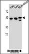 Tubulin Beta 6 Class V antibody, 56-125, ProSci, Western Blot image 