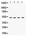 Ubiquitin Conjugating Enzyme E2 Q2 antibody, PA5-80202, Invitrogen Antibodies, Western Blot image 