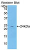 Spectrin Alpha, Non-Erythrocytic 1 antibody, LS-C292763, Lifespan Biosciences, Western Blot image 