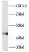 Testis Expressed 28 antibody, FNab08612, FineTest, Western Blot image 