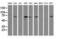 E3 ubiquitin-protein ligase MGRN1 antibody, M05951, Boster Biological Technology, Western Blot image 