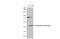Adenosine Deaminase antibody, GTX101390, GeneTex, Western Blot image 