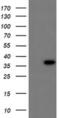 Carbonyl Reductase 3 antibody, MA5-25626, Invitrogen Antibodies, Western Blot image 