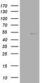 Nuclear Receptor Subfamily 2 Group C Member 1 antibody, LS-C338723, Lifespan Biosciences, Western Blot image 