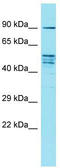 Family With Sequence Similarity 171 Member A2 antibody, TA335338, Origene, Western Blot image 