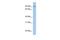 LRRC33 antibody, GTX45159, GeneTex, Western Blot image 
