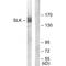 STE20 Like Kinase antibody, A01614, Boster Biological Technology, Western Blot image 