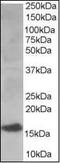 Ubiquitin Conjugating Enzyme E2 I antibody, orb95438, Biorbyt, Western Blot image 