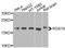 Regulator Of G Protein Signaling 10 antibody, A9948, ABclonal Technology, Western Blot image 