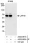 Torsin 1A Interacting Protein 1 antibody, A302-082A, Bethyl Labs, Immunoprecipitation image 